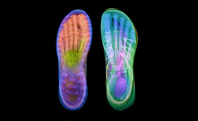 ruimte-tenen-hardlopen